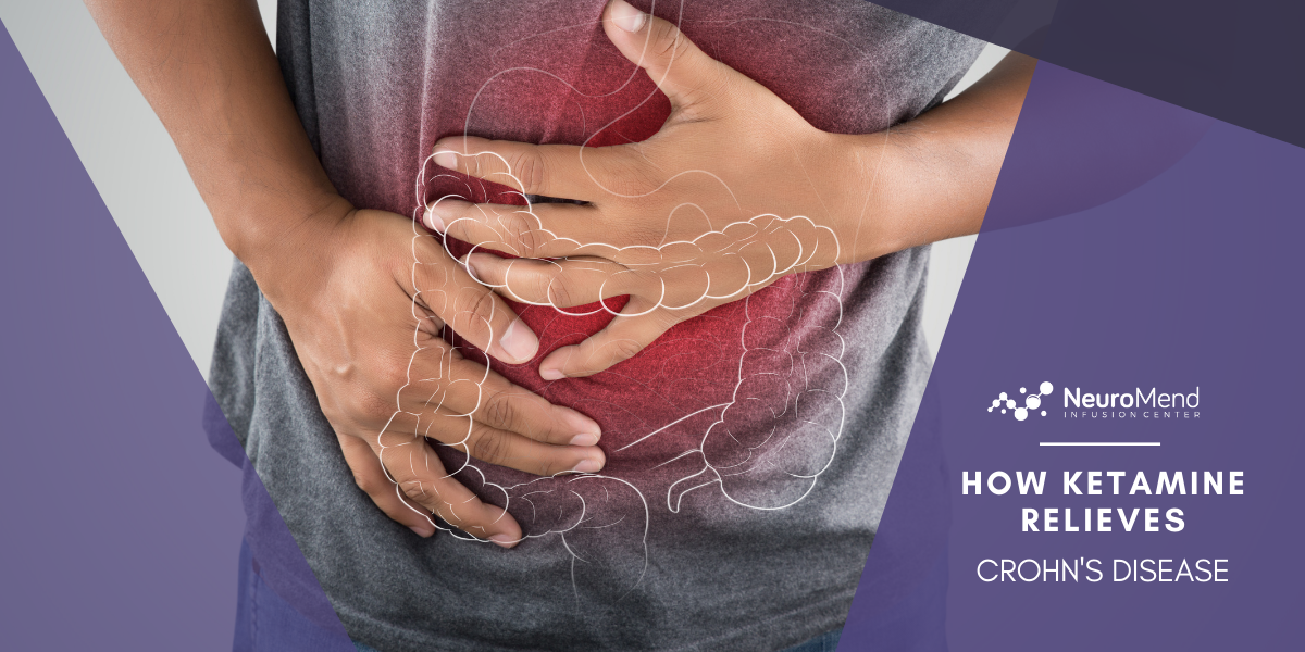 Can Ketamine Infusions Help Crohn's Disease?