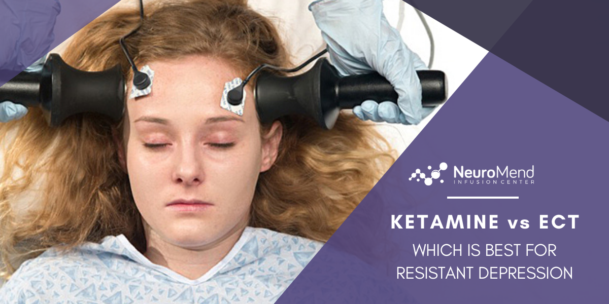 Ketamine vs ECT: Which Is Best For Resistant Depression | NeuroMend